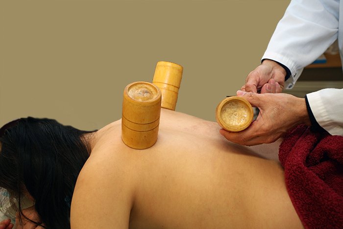 Bamboo Cupping